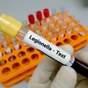 Provetta laboratorio legionella